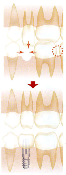 �C���v�����g���ÃC���[�W