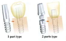 �C���v�����g�̎��